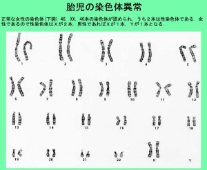 正常な染色体の画像