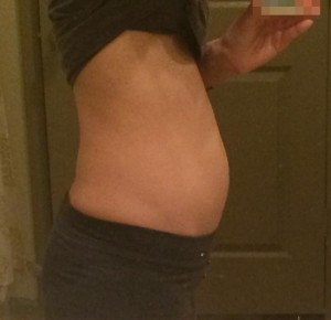 妊娠11週目（+6d）の写真