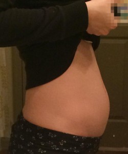 妊娠12週目（+6d）の写真