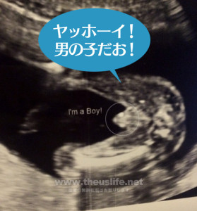 妊娠18週のエコー写真（男の子）