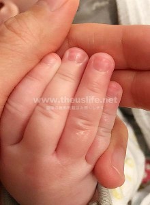 爪を削った後の赤ちゃんの指先