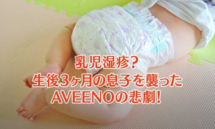 乳児湿疹 生後3ヶ月の息子がアトピー肌に 劇的に改善したクリームもご紹介 Techガールのuslife