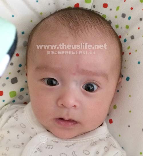 片目だけ二重まぶたに変化した生後二ヶ月の赤ちゃんの顔