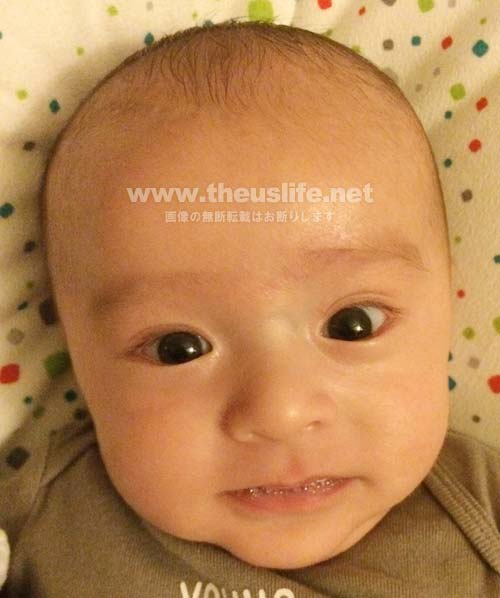 両目二重まぶたになった生後二ヶ月の赤ちゃんの顔