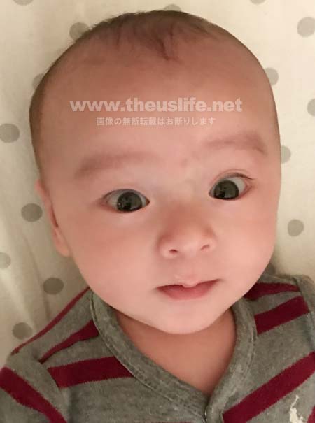 片目だけ二重まぶたの生後二ヶ月の赤ちゃんの顔